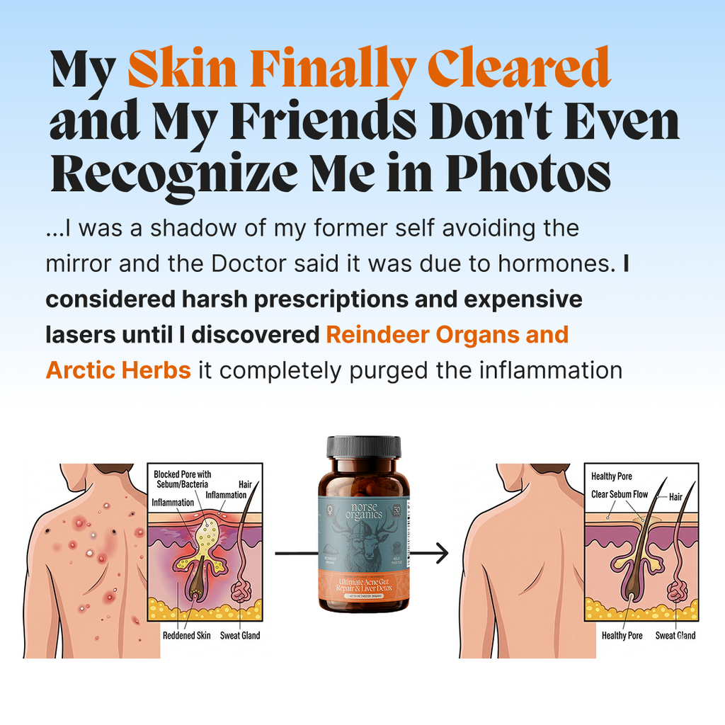 Complete Gut Repair & Hormonal Balance System for Male Acne