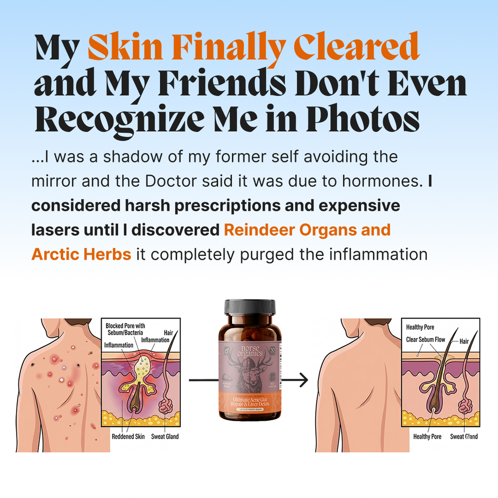 Complete Gut Repair & Hormonal Balance System for Female Acne